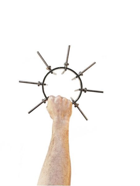 Couronne Anale Pour Fist Hole Expander Xtreme 6 Couronne Anale Pour Fist Hole Expander Xtreme – Image 6