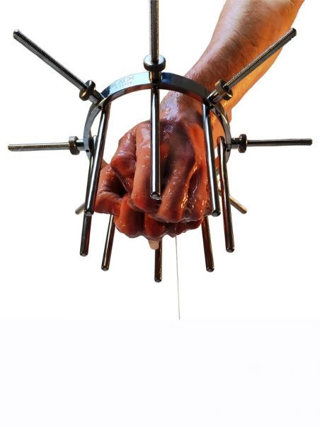 Couronne Anale Pour Fist Hole Expander Xtreme 1 Couronne Anale Pour Fist Hole Expander Xtreme